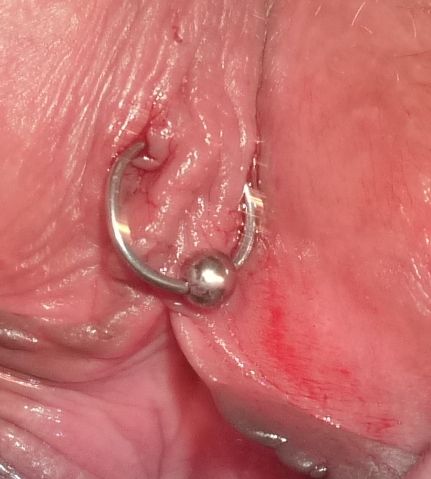 clit piercing