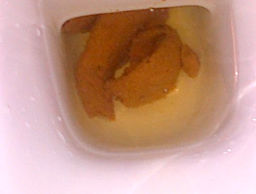My shit in the toilet