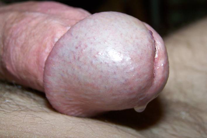 cock5