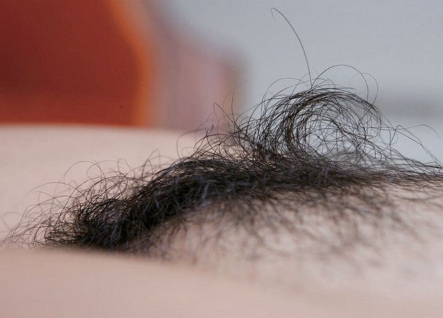 pelo