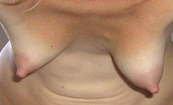 boobs-0908-22