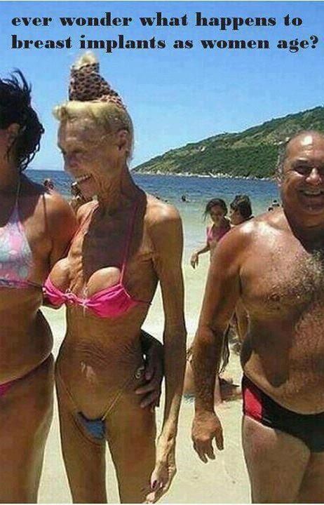 old age implants