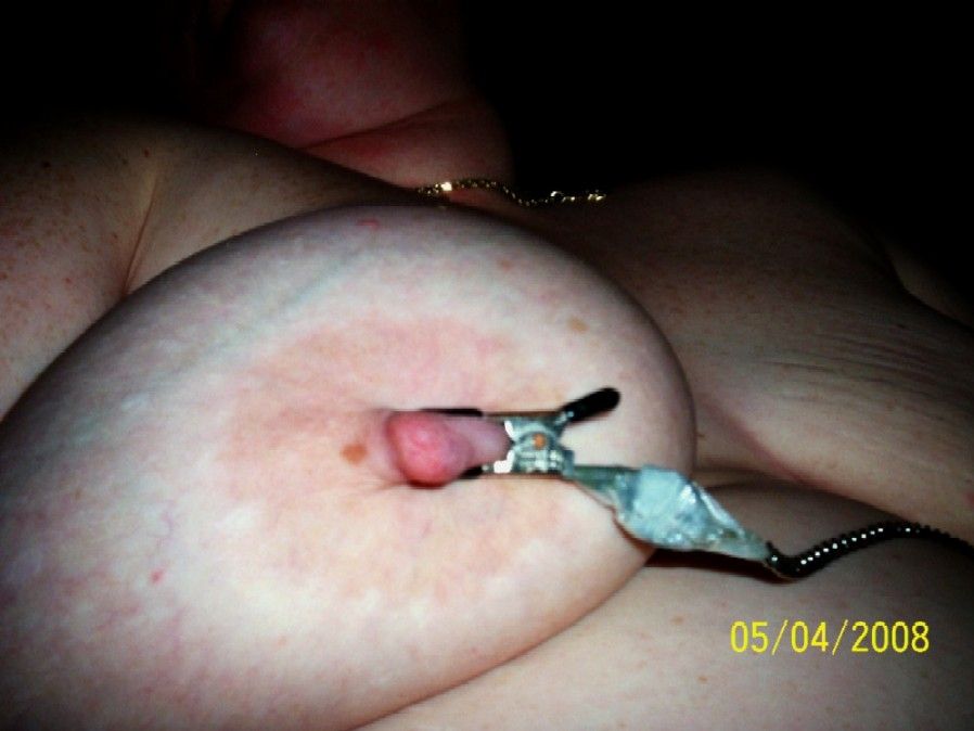 Wanda's nipple with a clamp on it 5-4-08