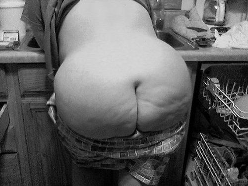 4443986997_dbbc6e5530_cellulite_fat_ass