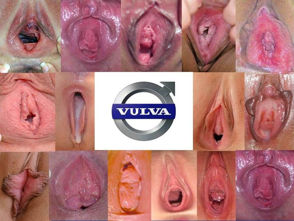 Vulvas