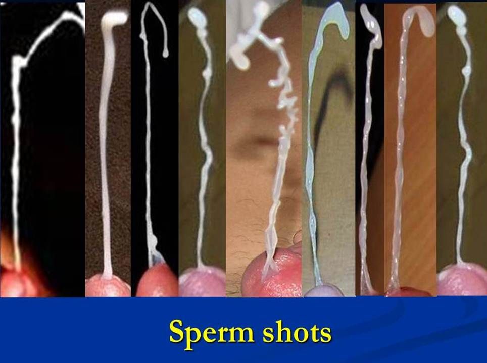 Sperm geysers