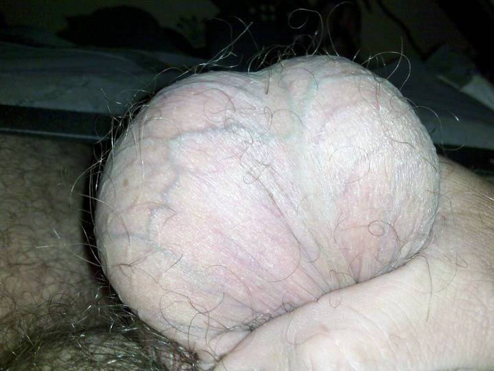 My balls