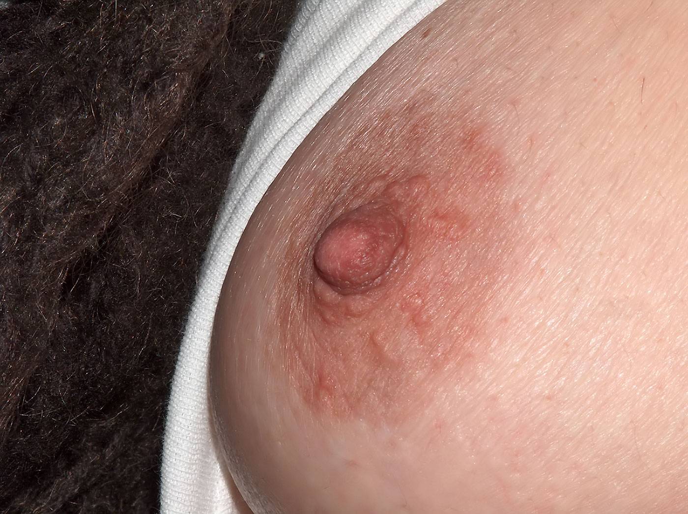 nipple1