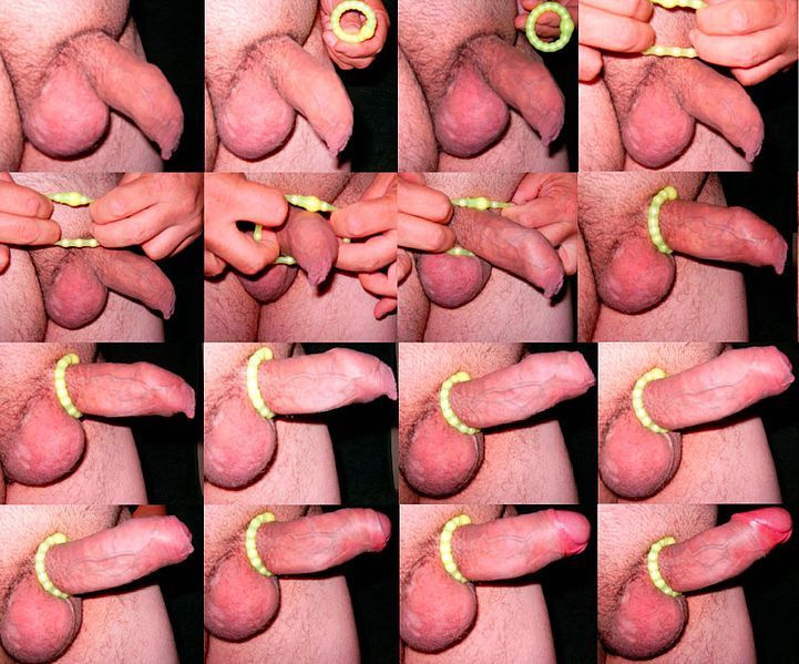 721px-Penis_Cock_Ring_Erection