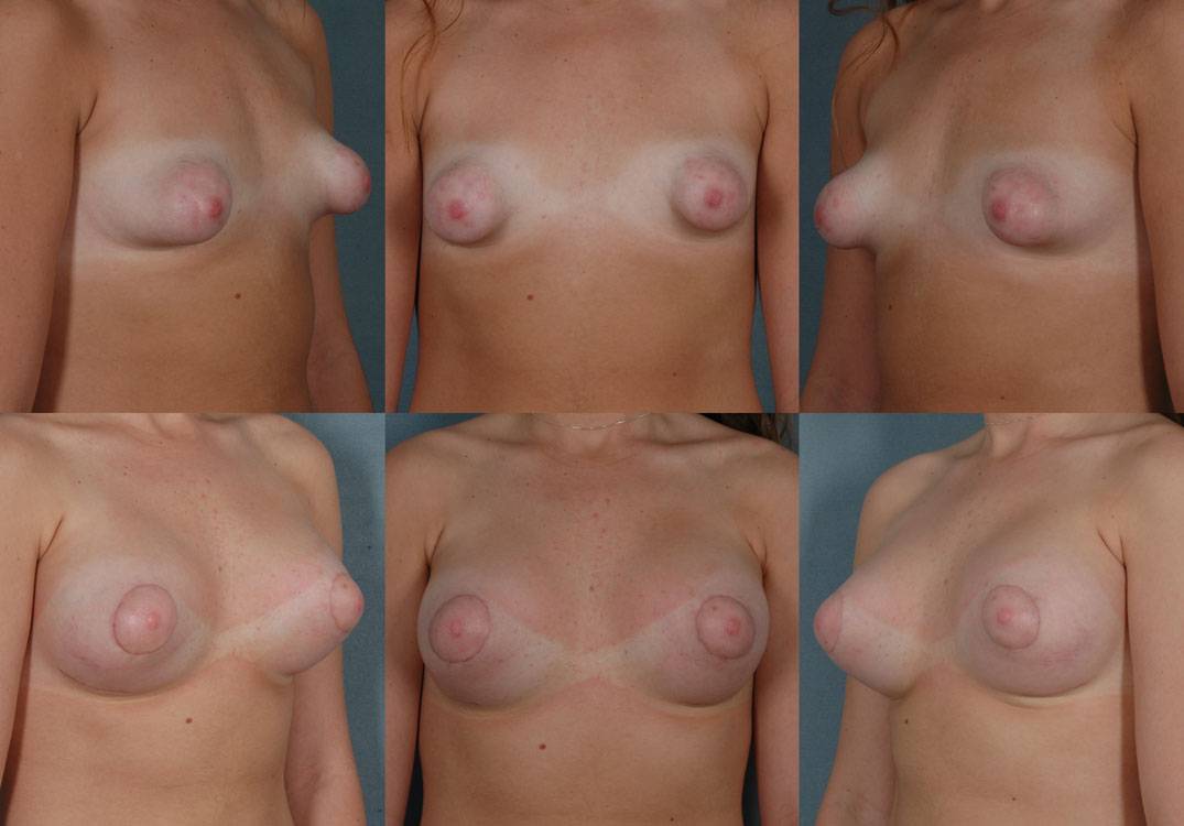 Challenging-Breast-Anomalies-11