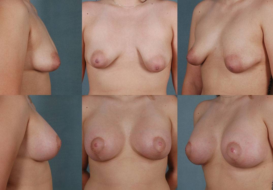 Challenging-Breast-Anomalies-12