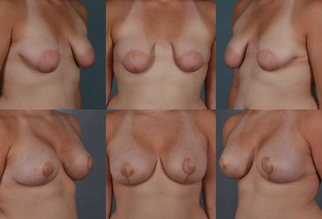 Challenging-Breast-Anomalies-13