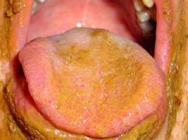 Dirty Tongue