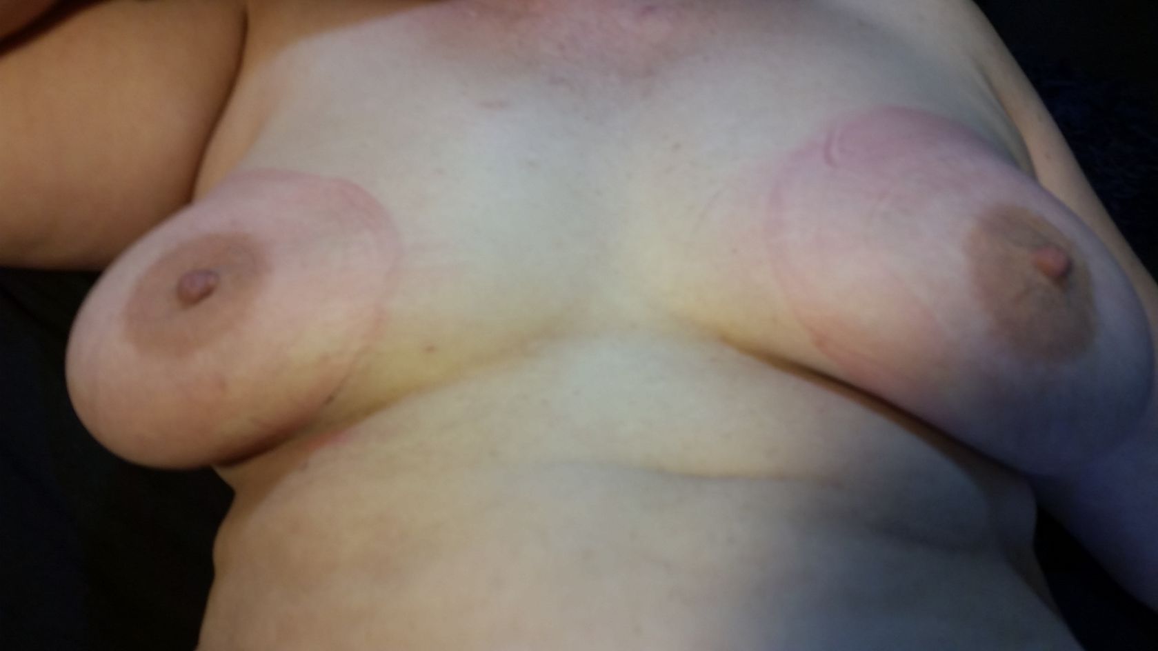Laurie Bruised Tits