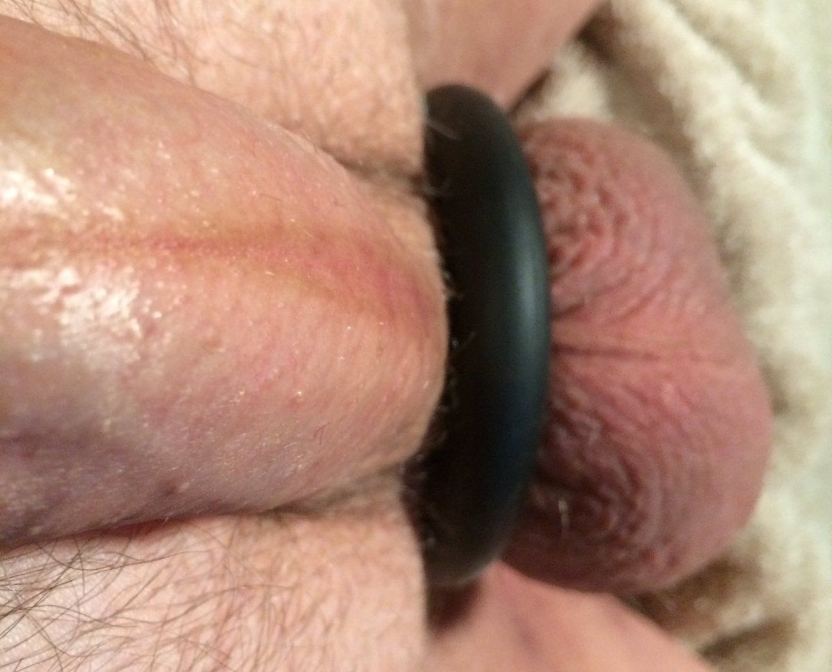 Cock-Ring-2772