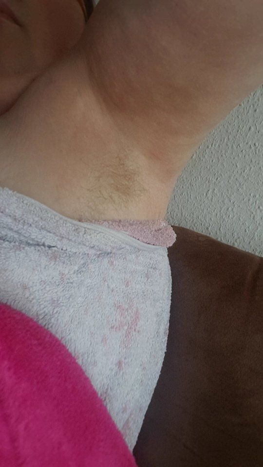 Bibis Achselhaare / Hairy Armpits