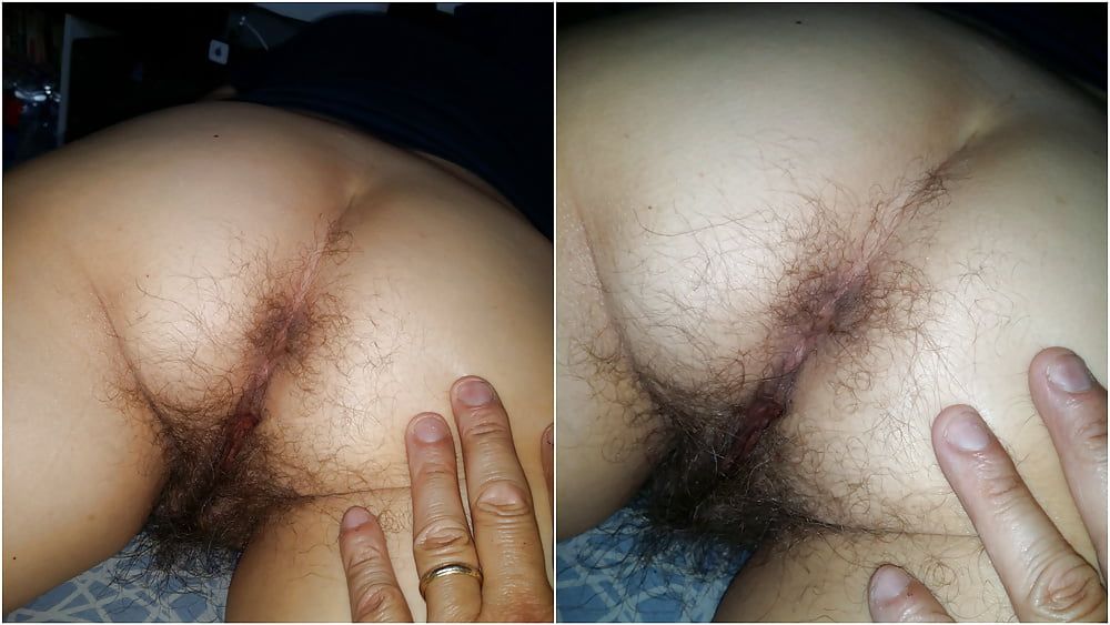 Hairy asses