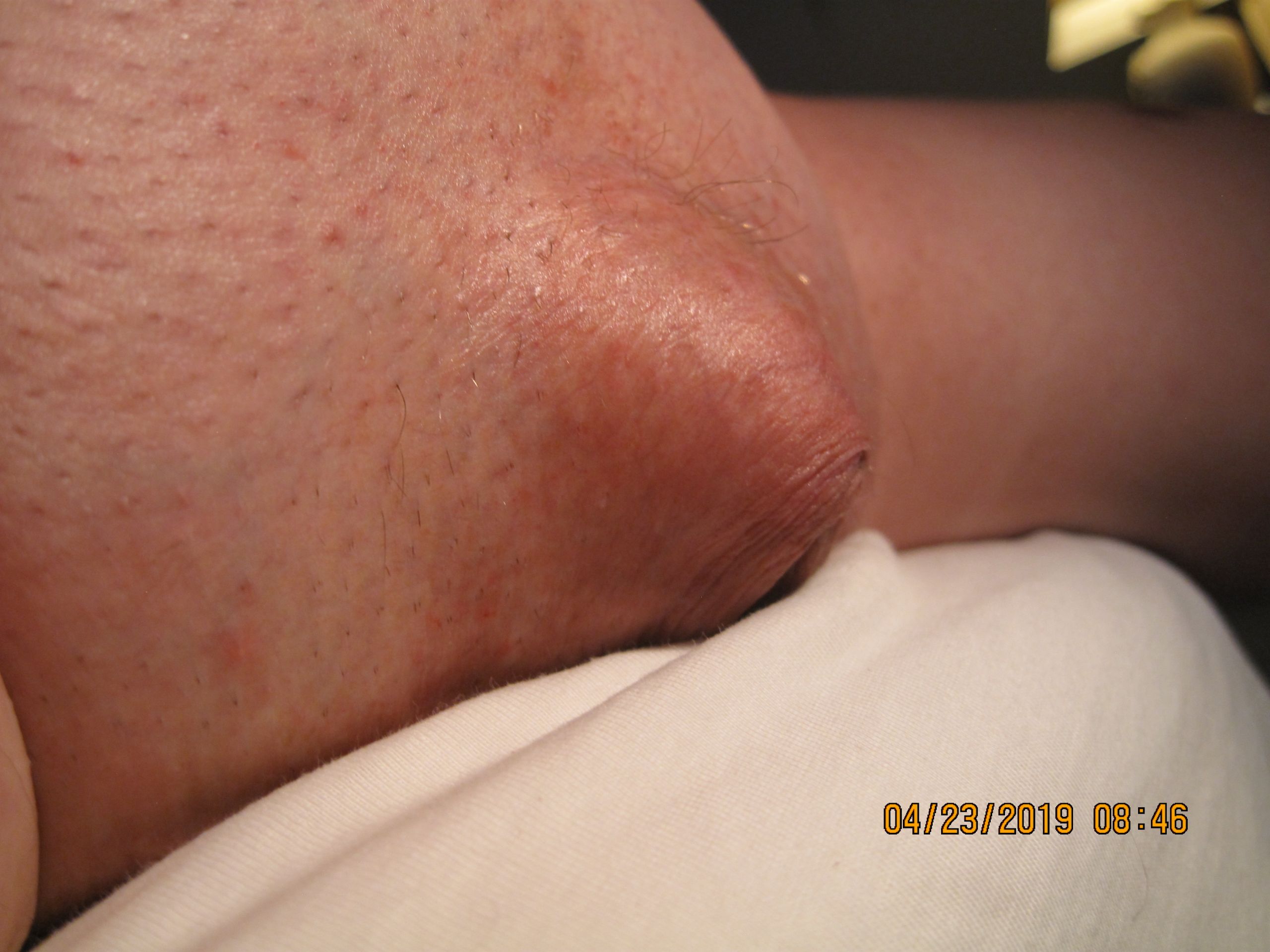 04-23-2019 Tiny Dick Shaven Big Balls 036