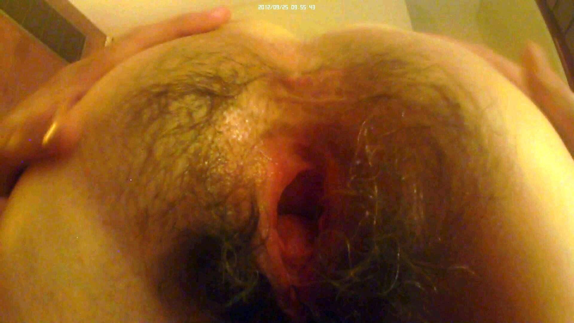 hairy and gaping