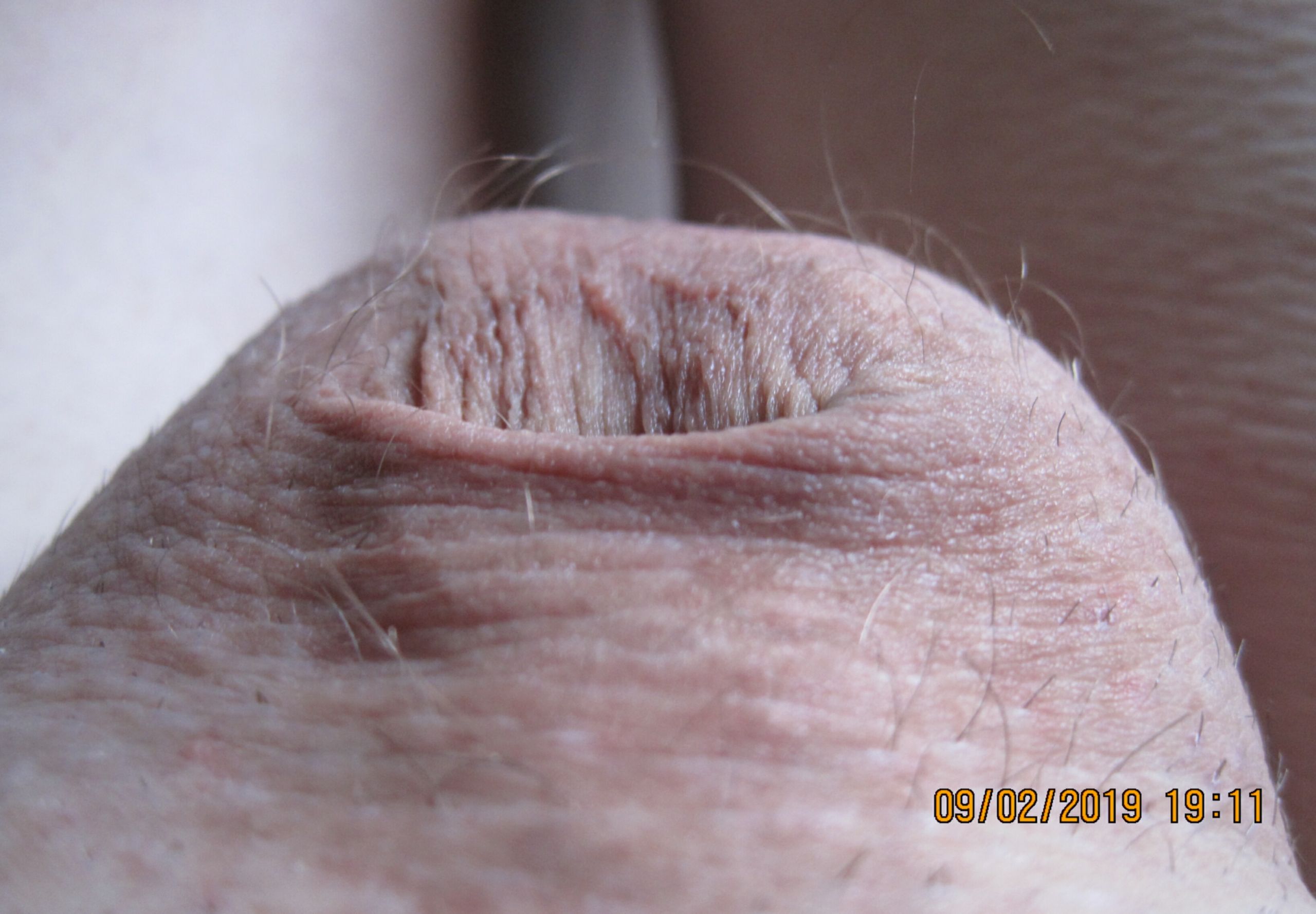 09-02-2019 Tiny Dick Huge Balls 011