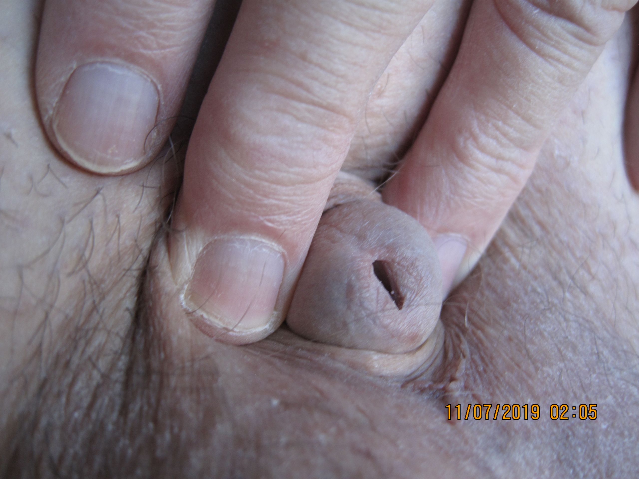 11-07-2019 Tiny Dick Huge Balls 060