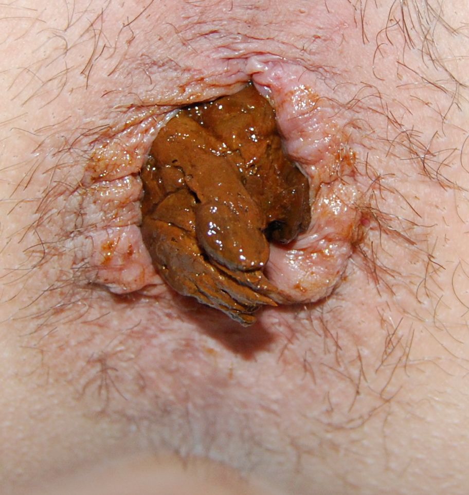 Large crotte, anus béant, plaisir bucal, sperme abondant (36)
