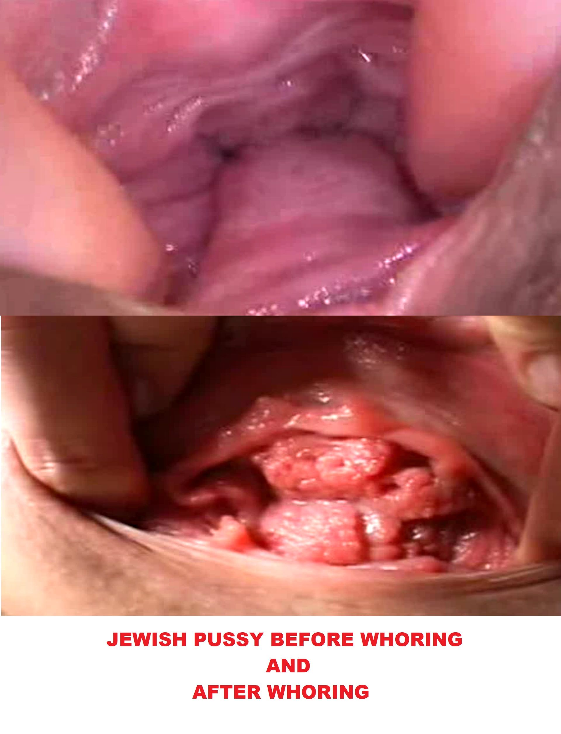 Jewish pussy