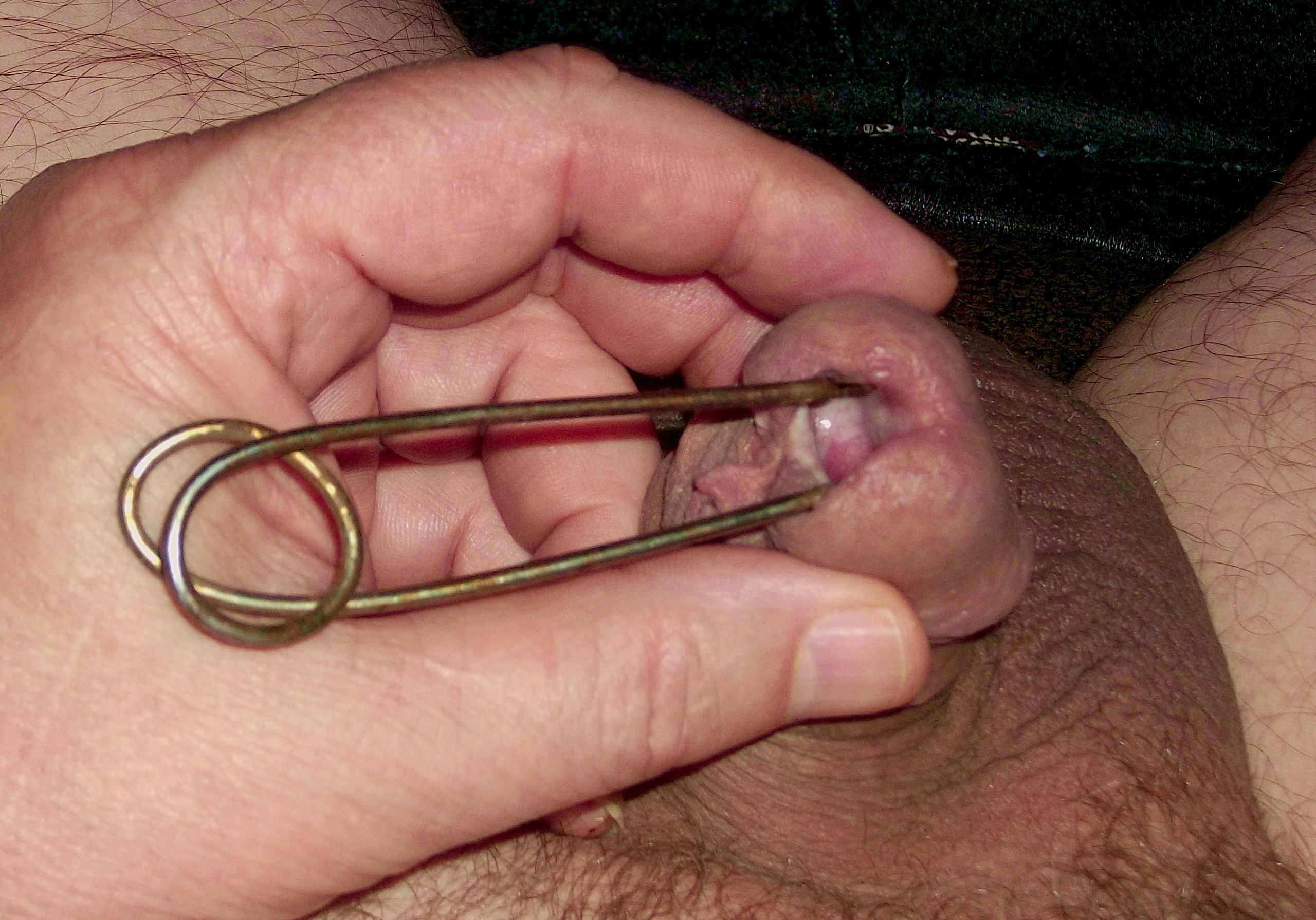 speculum_usage