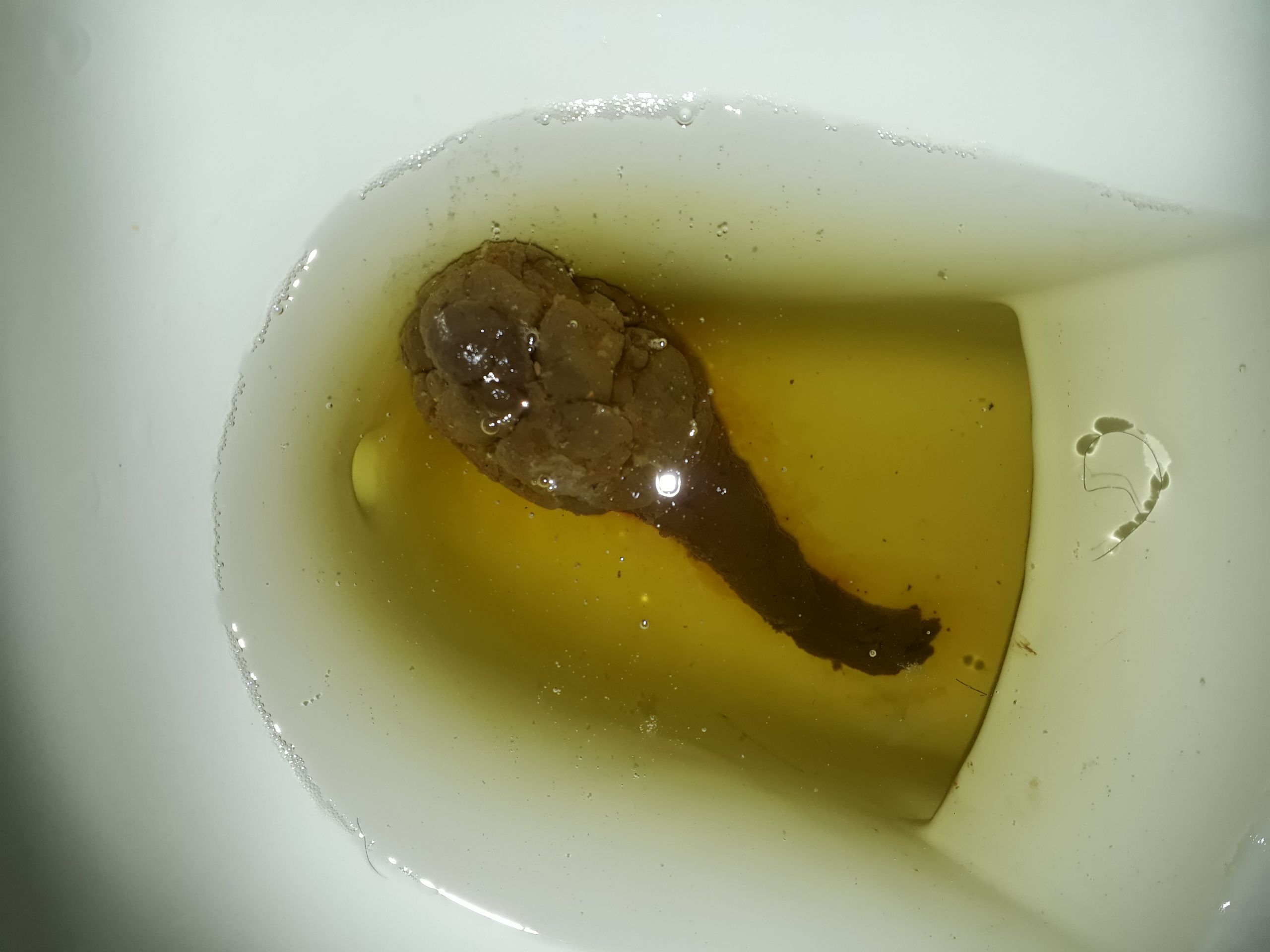 My shit sperm