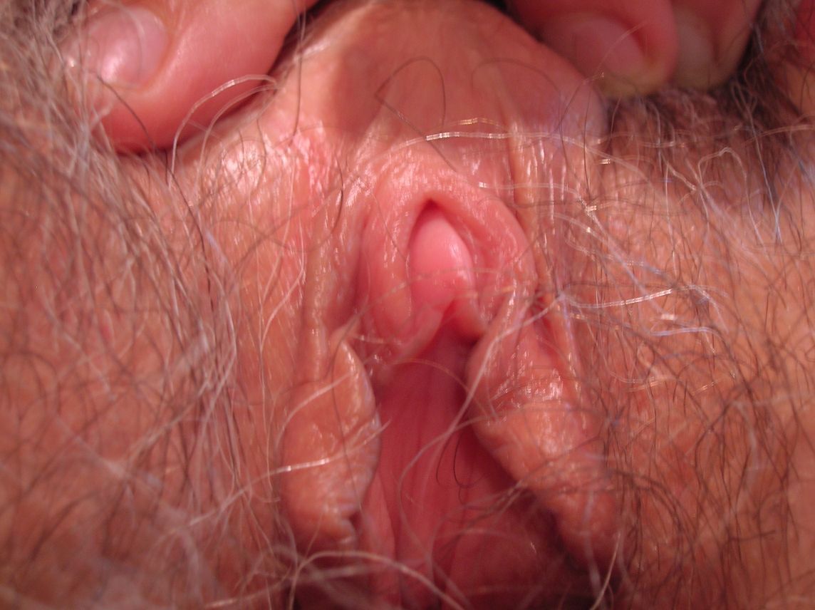 swollen-clitoris-macro-2-halfsize