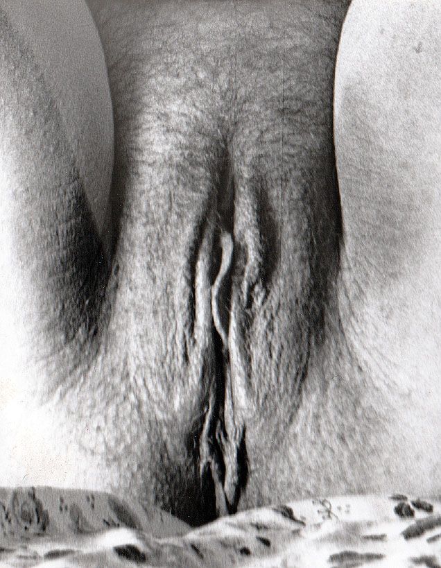 Hairy black and white