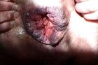 Gape 1