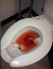 Bloody toilet