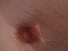 Mein Nippel links