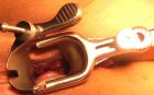 speculum