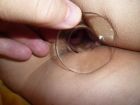 speculum anal