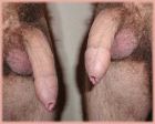 foreskins_cock_jpg