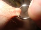 pierced ring 3