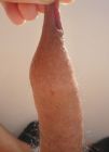 2-stretching-a-long-foreskin