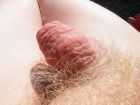 Nettle Play Foreskin 05