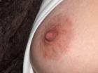 nipple1
