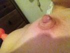 Swollen nipple