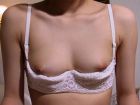 inverted nipples (20)