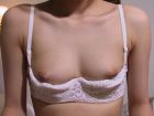 inverted nipples (60)