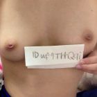 inverted nipples (65)
