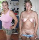 Mature Before & After (4)