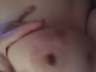 Bitten and bruised tits