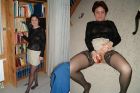 Mature Before & After (4)