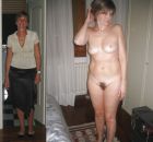 Mature Before & After (6)