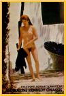 Jacqueline Kennedy Onassis full frontal nude paparazzi photo